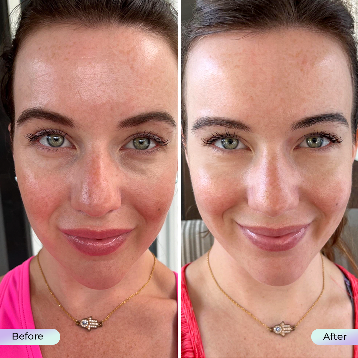 Aduro Facial Mask